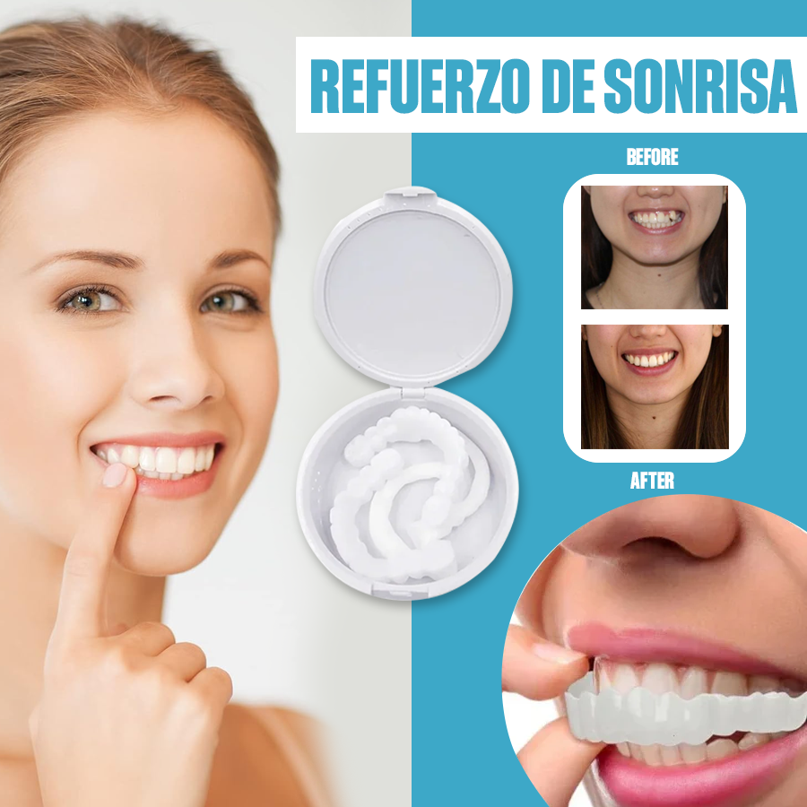 🔥 OFERTA EXCLUSIVA | LuxSmile™ Brackets de imitación para una sonrisa perfecta