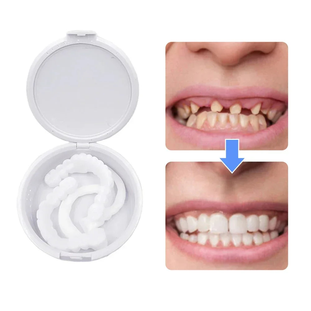 🔥 OFERTA EXCLUSIVA | LuxSmile™ Brackets de imitación para una sonrisa perfecta