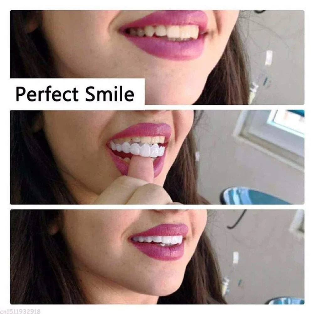 🔥 OFERTA EXCLUSIVA | LuxSmile™ Brackets de imitación para una sonrisa perfecta